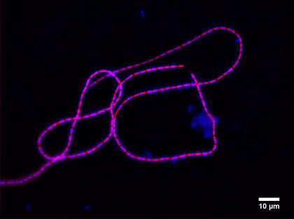 Cable bacteria: A new form of life