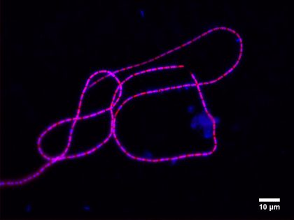 Cable bacteria: A new form of life